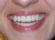 bel sorriso ancona