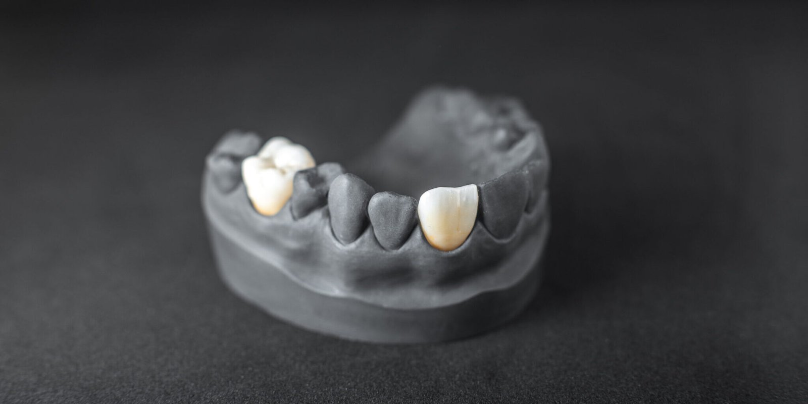 capsula dentale ancona