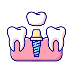 impianti dentali ancona