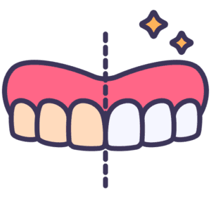 sbiancamento dentale ancona