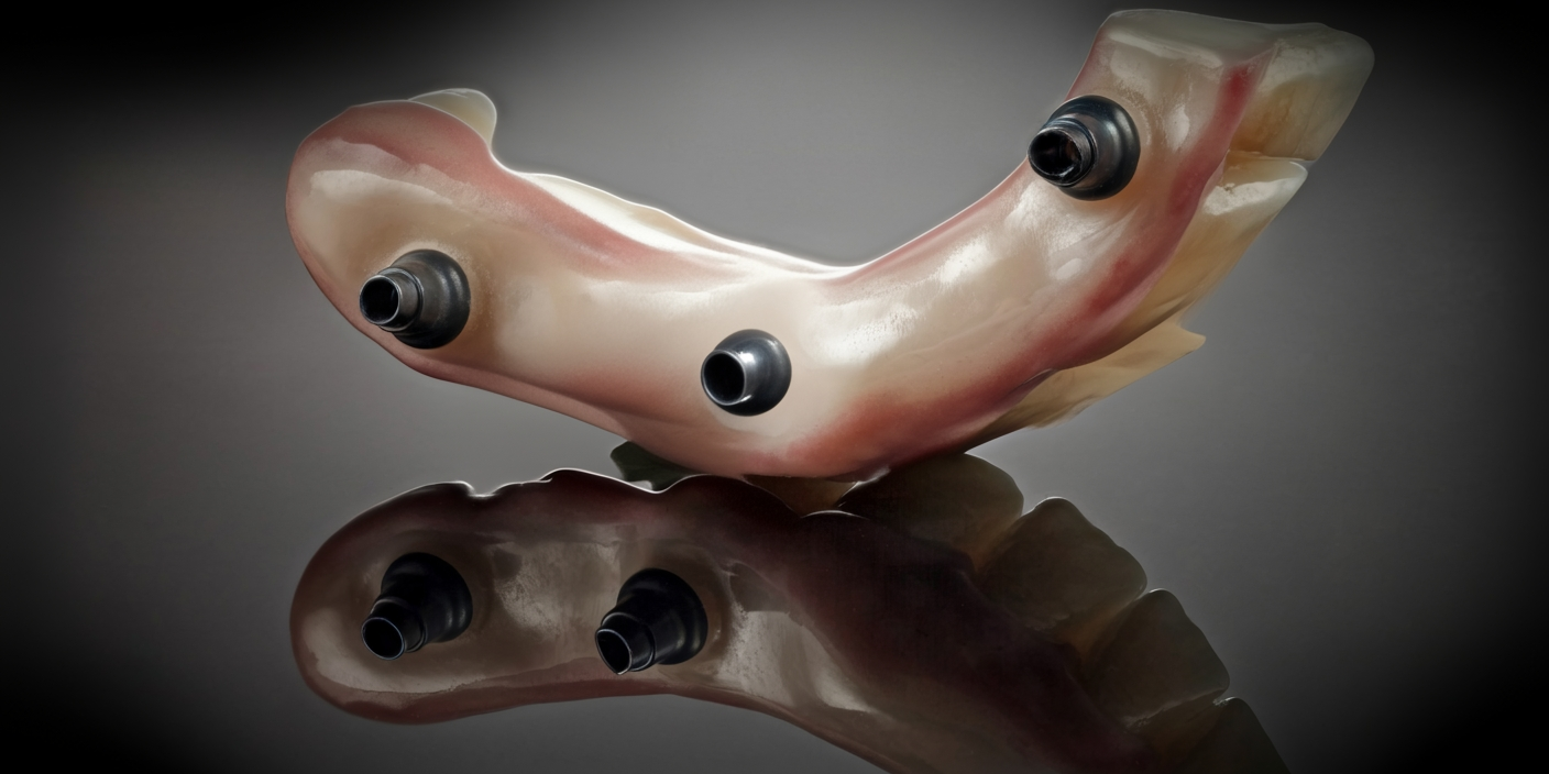 impianti all on four ancona