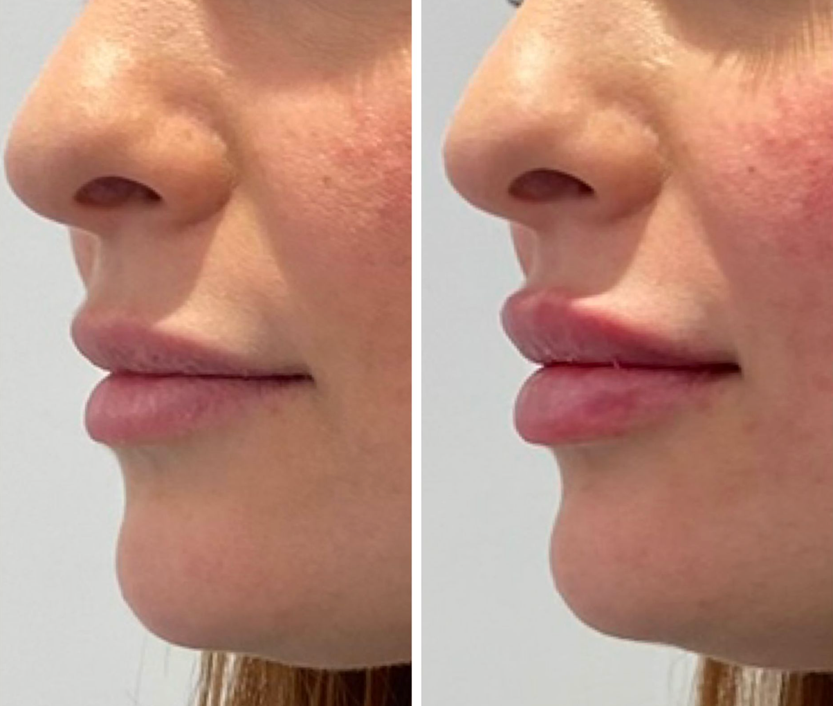 Analisi delle proporzioni labiali